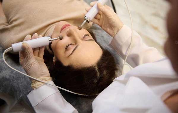 Microdermabrasion in London, Ontario: The Best Skin Exfoliation Treatment